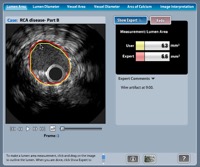 TeachIVUS MAX Award Winner 2004